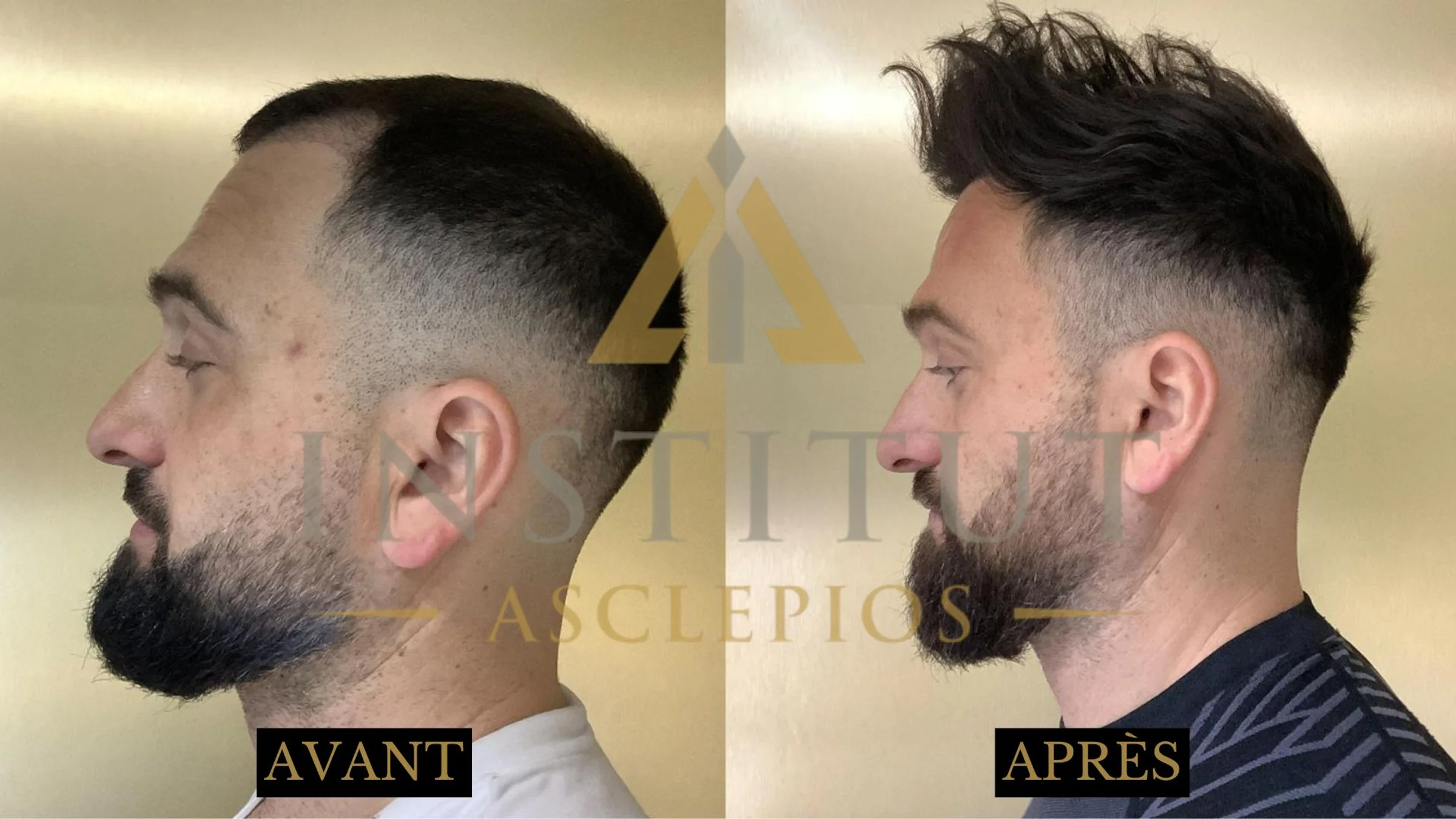 Institut Asclepios, Dr Claude Martin, Strasbourg, France -  -  : 2011