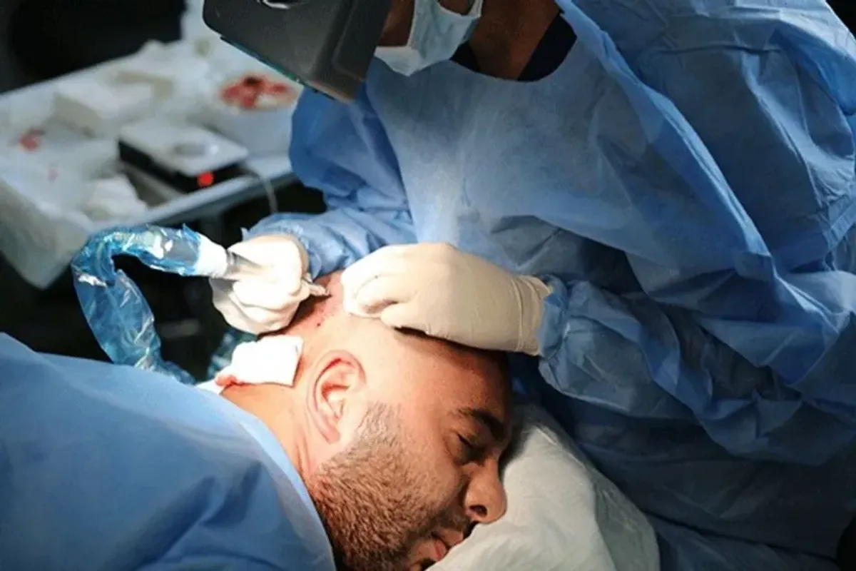 HDC Hair Transplant Clinic, Nicosia, Cyprus